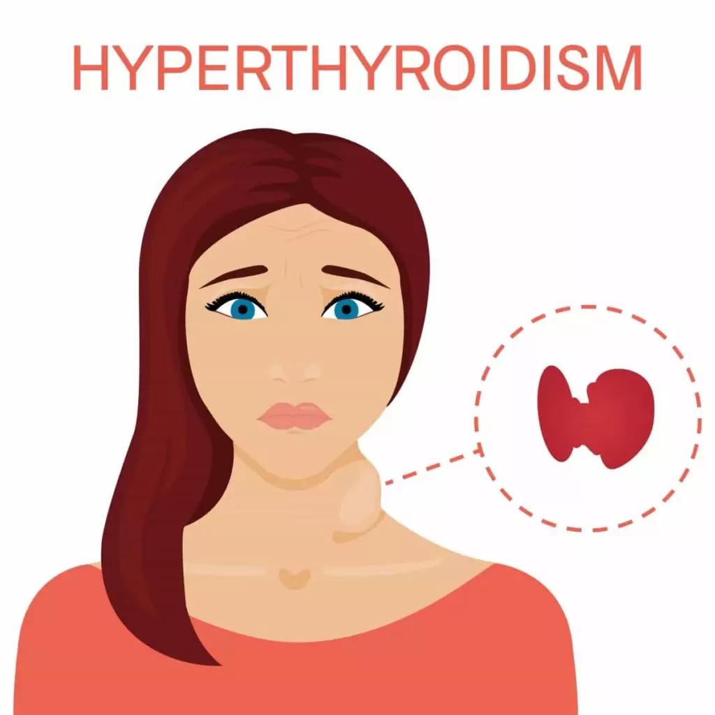 hyperthyroidism in girl